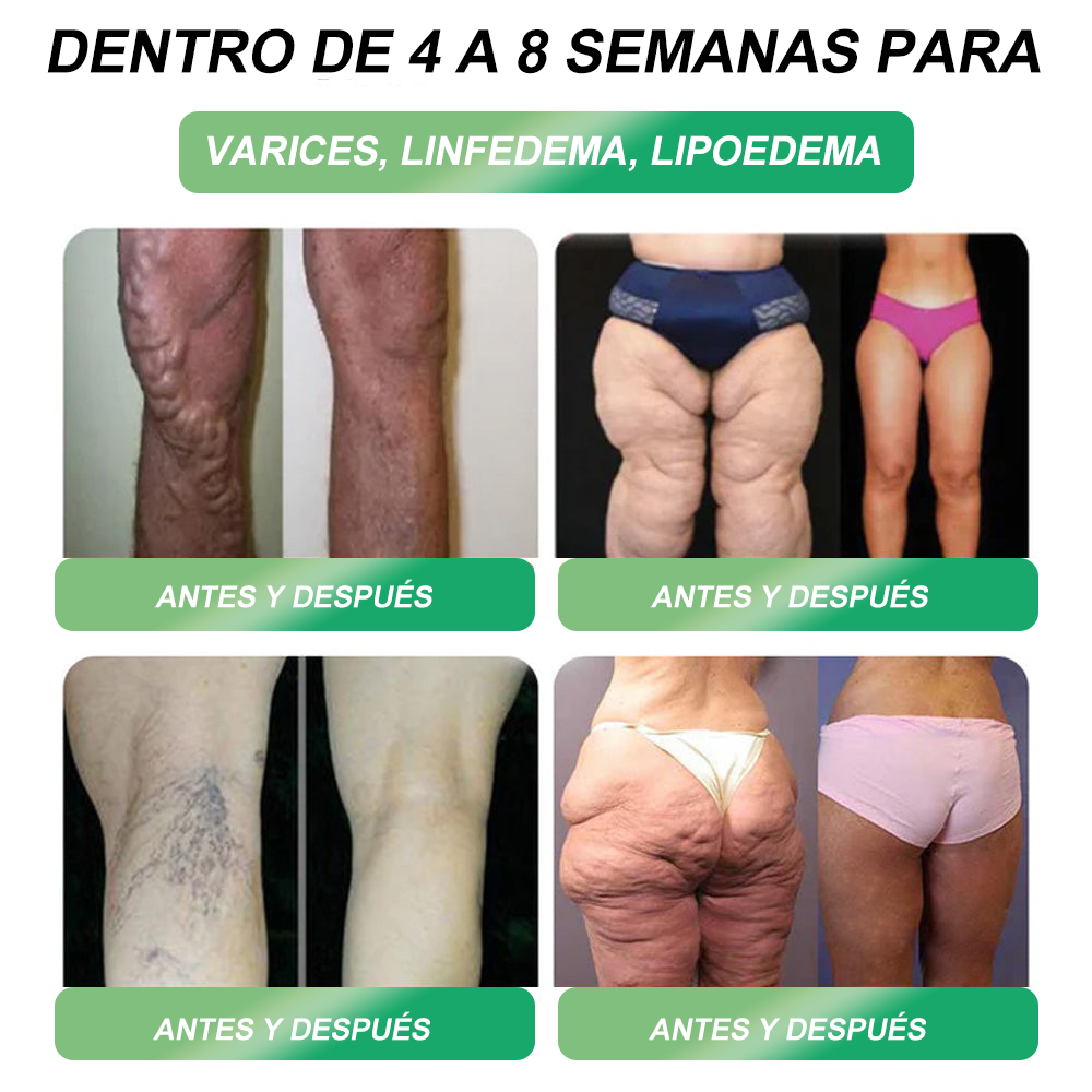 La salud corporal total comienza aquรญ | ๐๐๐๐๐๐ ๐๐๐๐๐๐๐ | Piguiayยฎ โฌ๏ธ ๐บ๐ฟ๐-1 ๐๐๐๐ข๐๐๐ฬ๐ ๐๐๐๐ ๐๐๐๐ ๐๐ฬ๐๐๐๐๐ ๐๐ ๐๐๐ ๐ โ ๐ฅ ๐๐๐๐ ๐๐๐๐, ๐ธ๐๐๐๐๐๐๐๐๐๐๐ ๐ถ๐๐๐๐๐๐ฃ๐๐ ๐๐ข๐๐๐๐๐ , ๐ท๐๐๐๐๐ก๐๐ , ๐ด๐๐๐๐ ๐๐ ๐๐ข๐๐ฬ๐, ๐๐๐๐๐๐๐๐๐ ๐ด๐๐ก๐๐๐ข๐๐๐๐๐ ๐ฆ ๐๐ฬ๐ โฌ๏ธ
