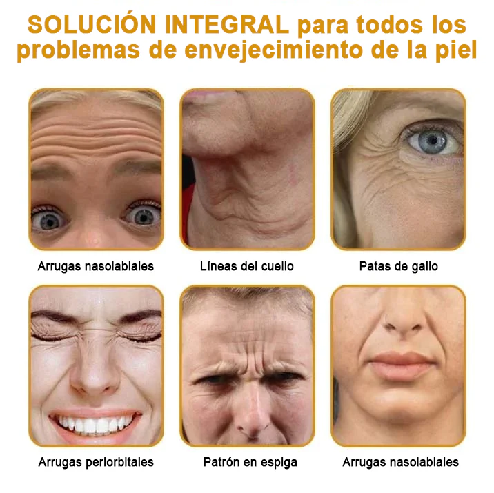 Awzlove™ Crema Anti-Arrugas con Botox y Veneno de Abeja | Aprobado por COFEPRIS 🌲