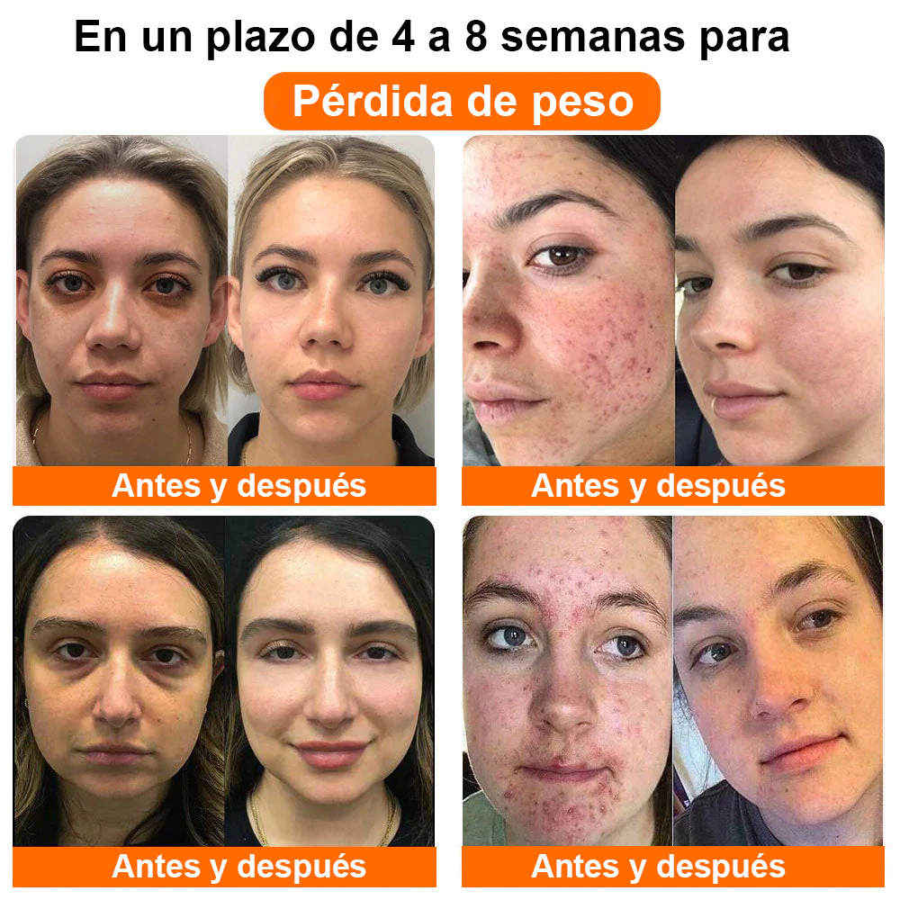 ¡Disfruta de un 30% de descuento al agregar el segundo! 🎁