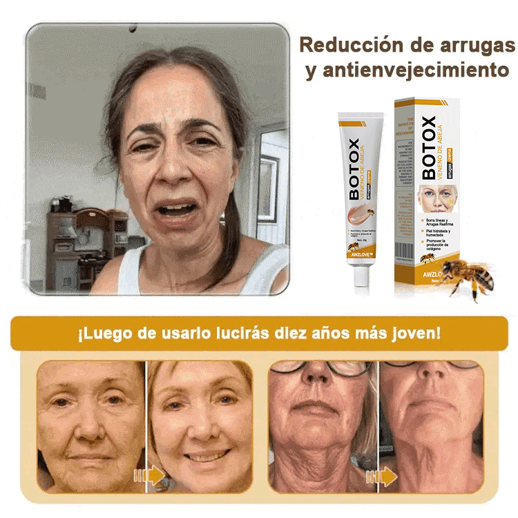 Awzlove™ Crema Anti-Arrugas con Botox y Veneno de Abeja | Aprobado por COFEPRIS 🌲