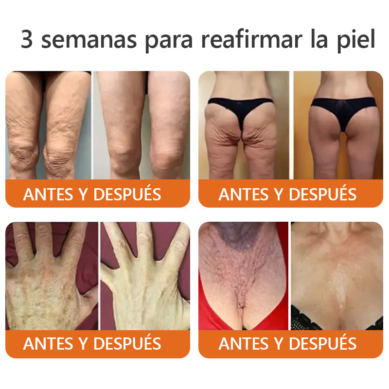 Awzlove™ Suero reafirmante en barra con veneno de abeja y botox (🇲🇽AMEDE recomendar)🇲🇽