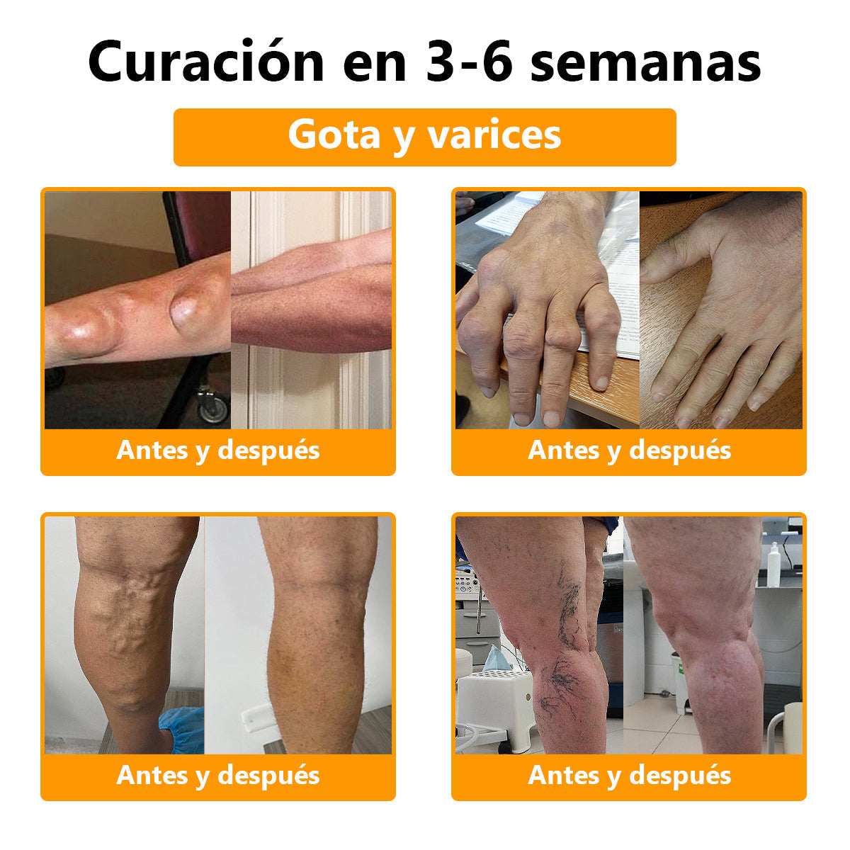 ¡Disfruta de un 30% de descuento al agregar el segundo! 🎁