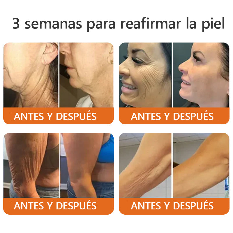 Awzlove™ Suero reafirmante en barra con veneno de abeja y botox (🇲🇽AMEDE recomendar)🇲🇽